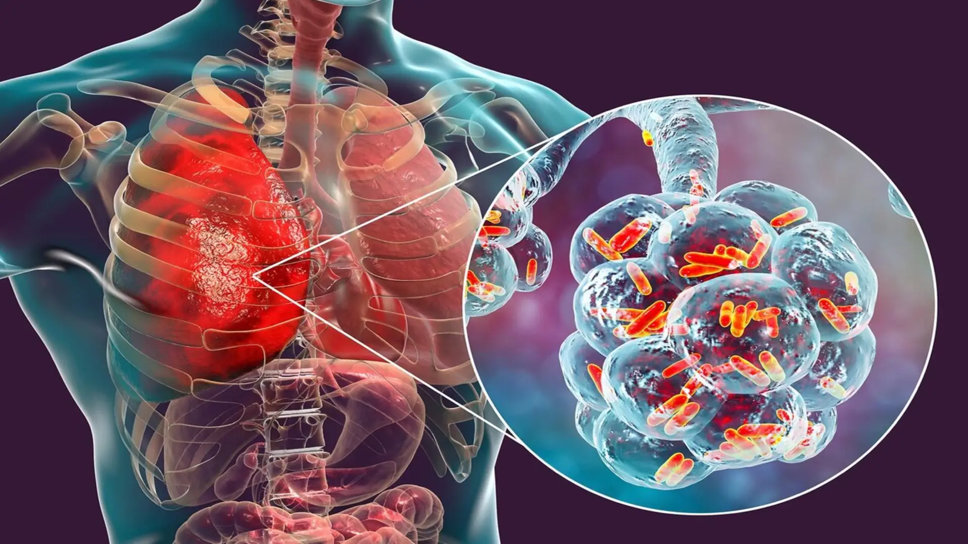 1e9c0d1e 20f2 44ac a671 654436b4231b